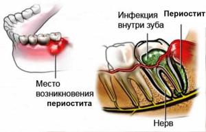 Где находится надкостница зуба фото