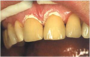 Понятие, функции и строение цемента специфической костной ткани человеческого зуба