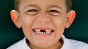 Какие зубы у ребенка 5 лет thumbnail
