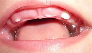 Рост зубов у ребенка 4 года thumbnail